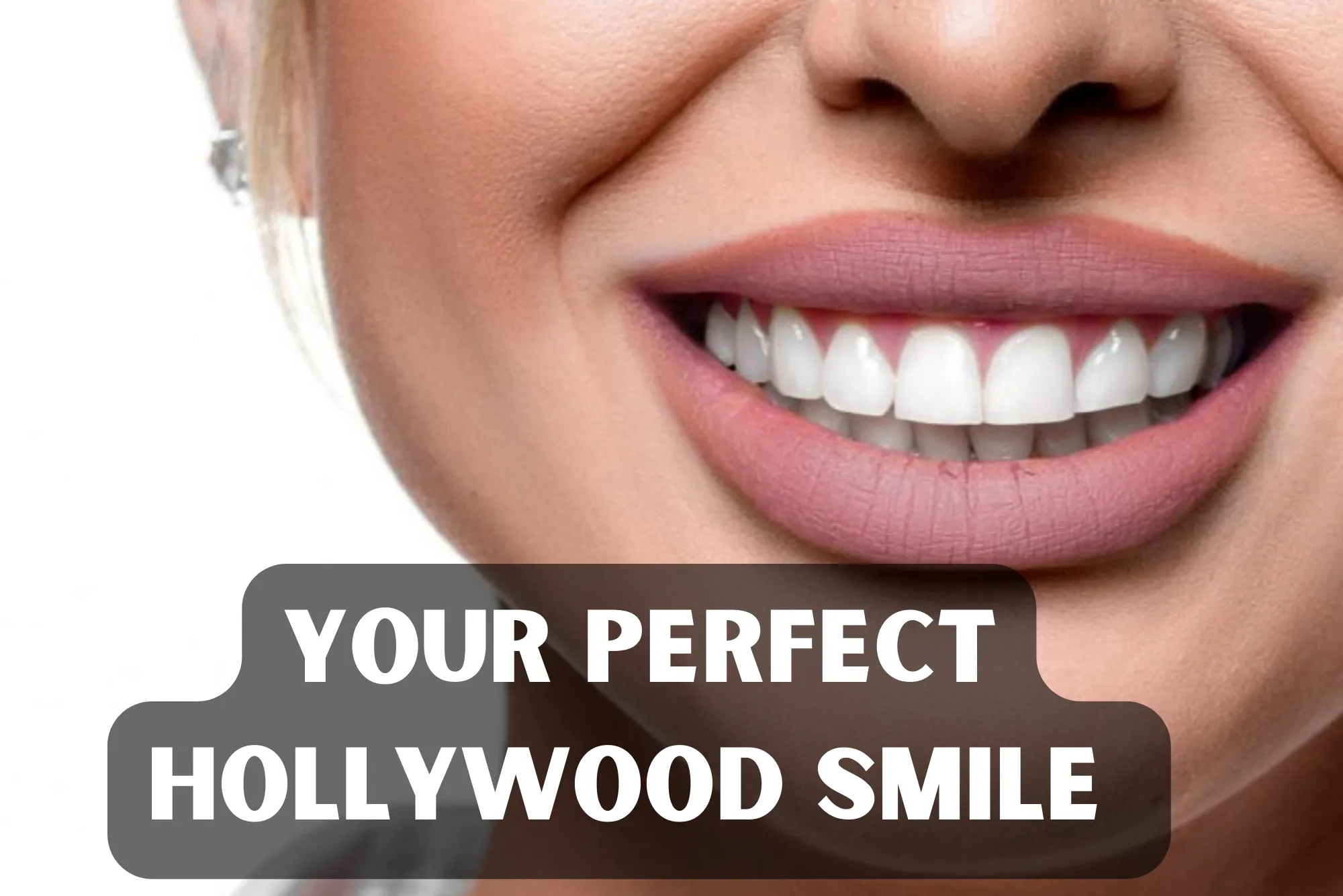 Achieve Your Dream Hollywood Smile in Dubai Expert Services
