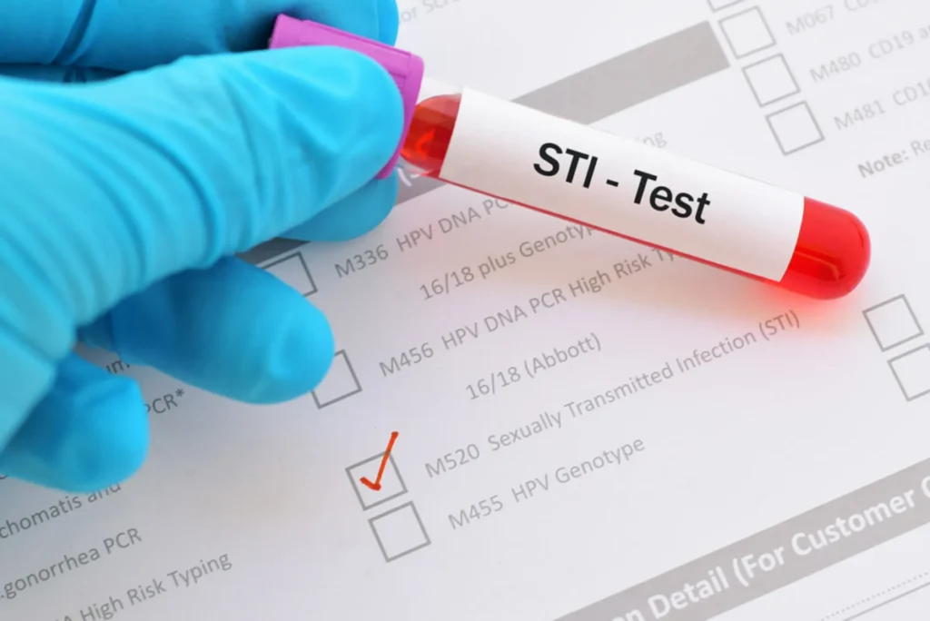 STI Testing in Dubai